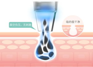mks美克斯電動(dòng)毛孔清潔器 告別黑頭粉刺，開啟深層凈澈護(hù)膚時(shí)代